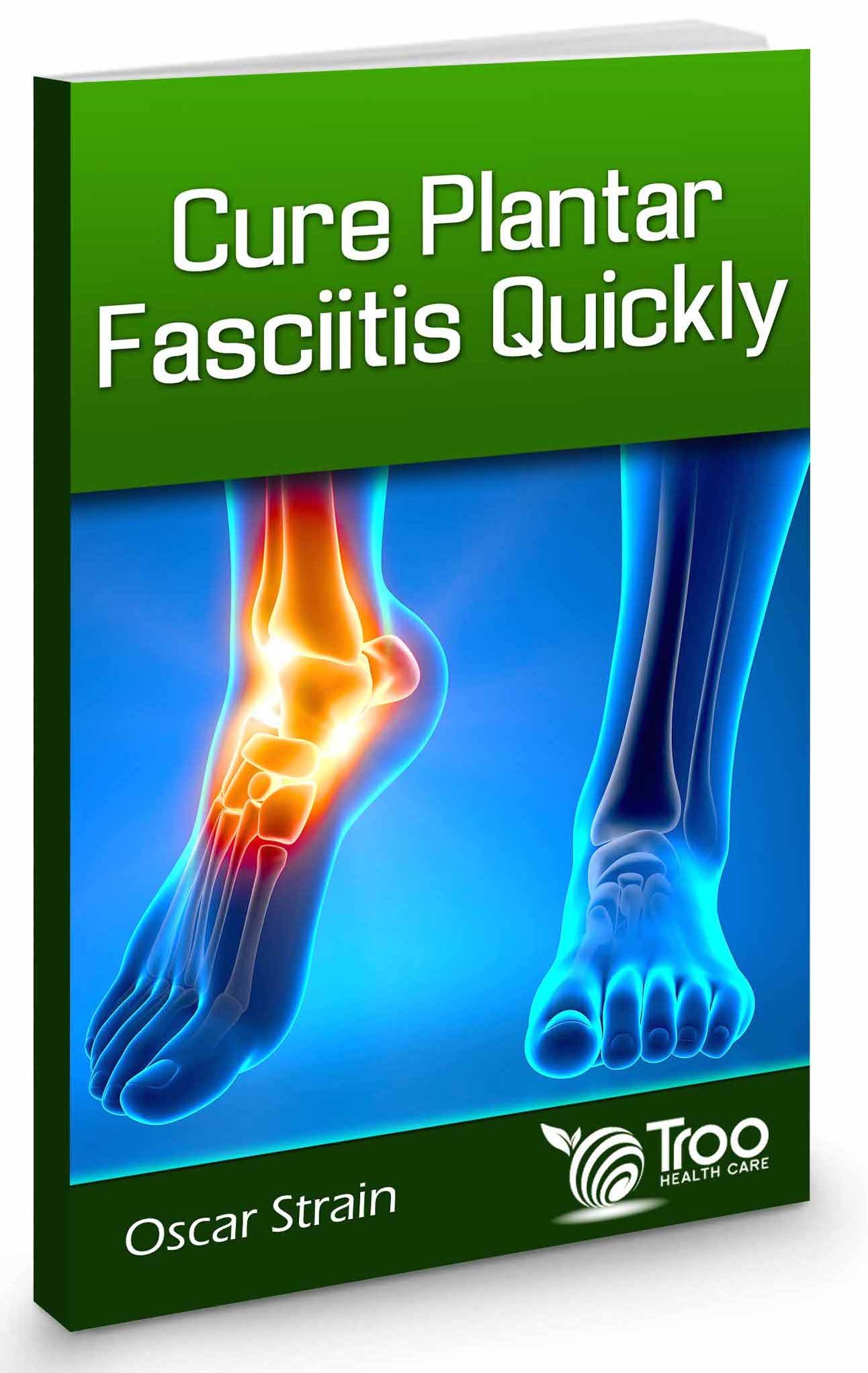 Plantar Fasciitis Treatment Using Troo Step Insoles Relief